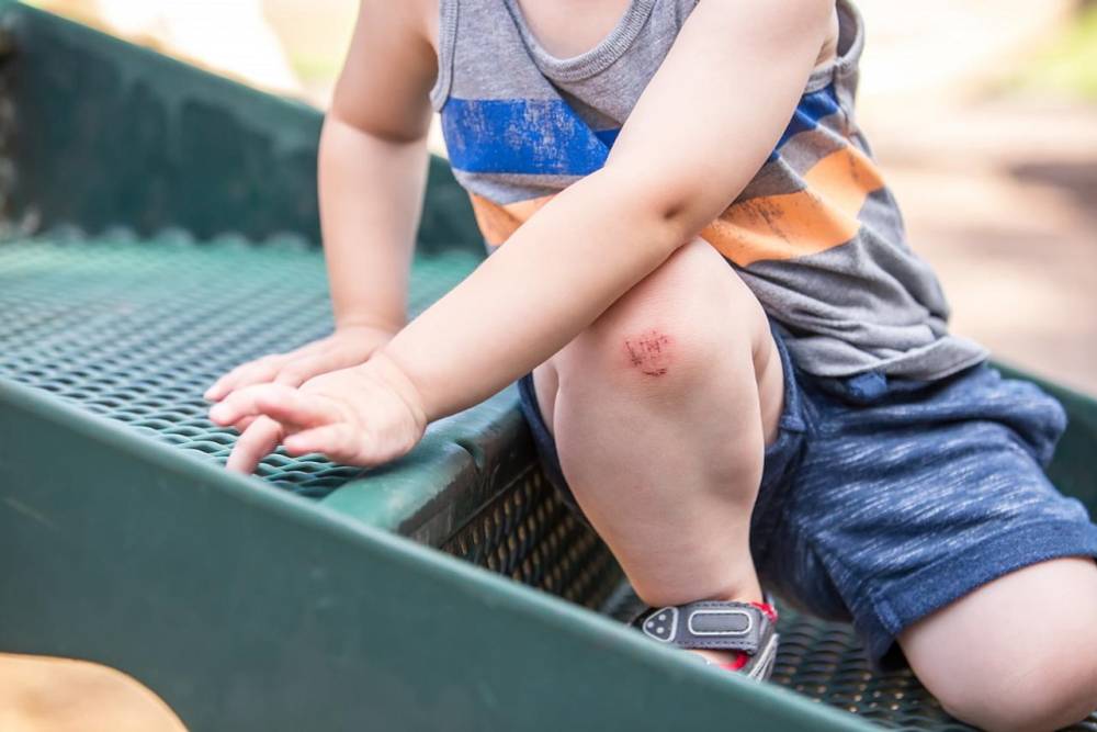 Care of minor injuries and abrasions in children