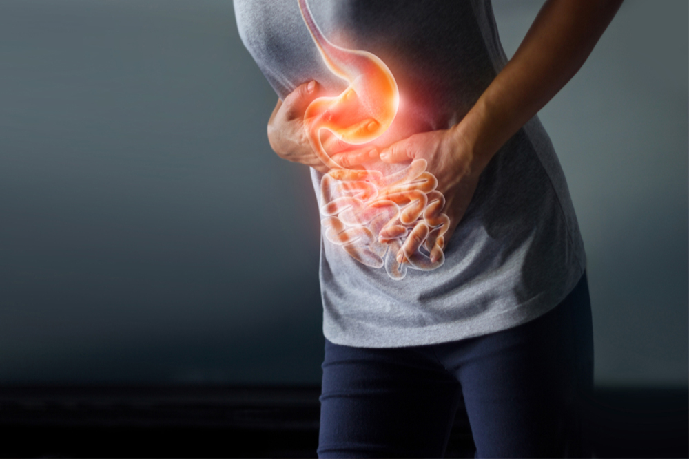 Functional dyspepsia or upset stomach