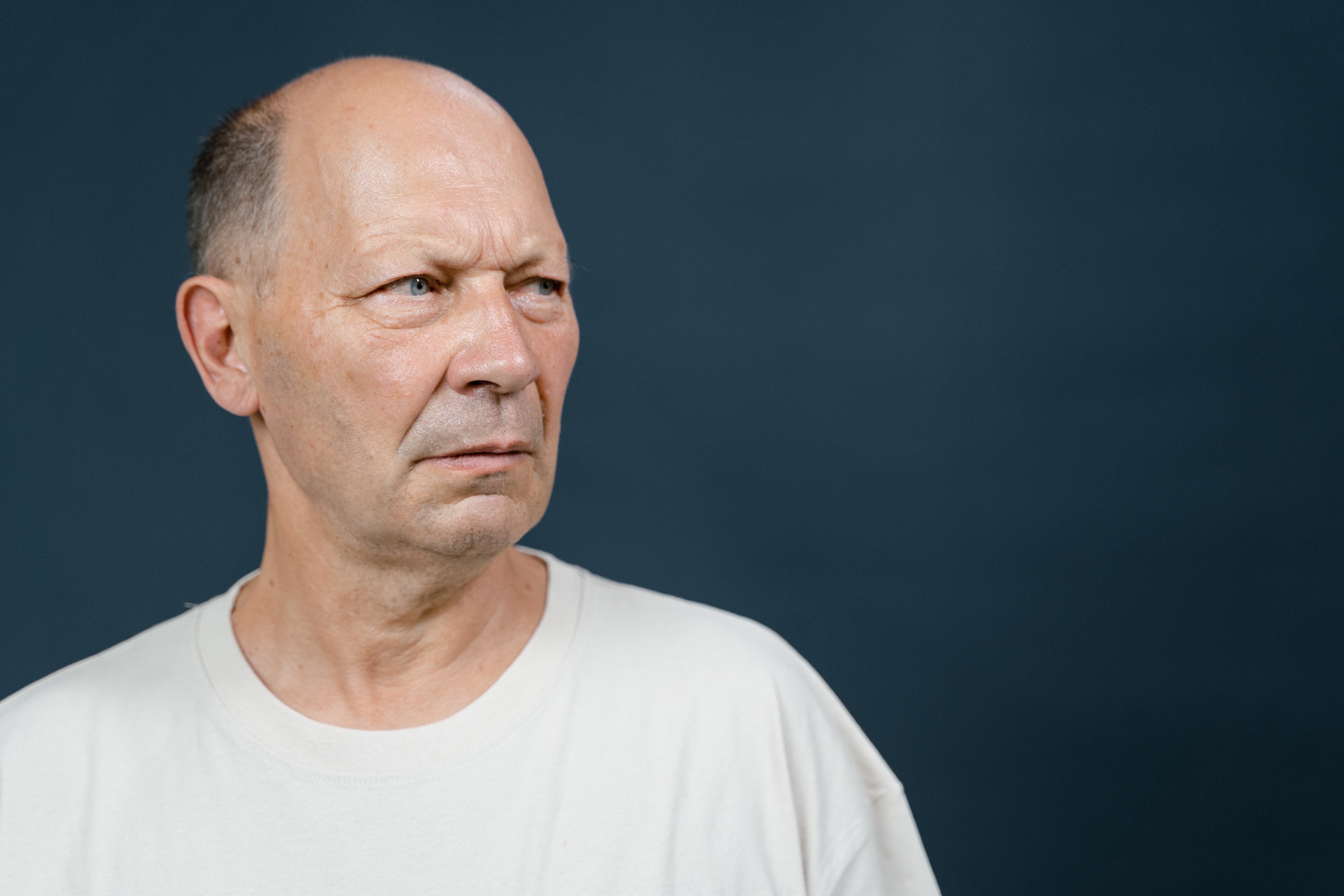 DOES HAIR LOSS MEDICATION CAUSE IMPOTENCE?